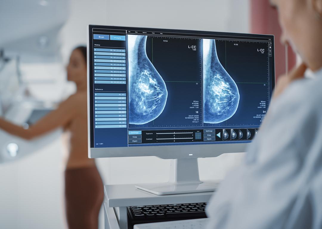 An adult woman undergoing a mammography procedure.