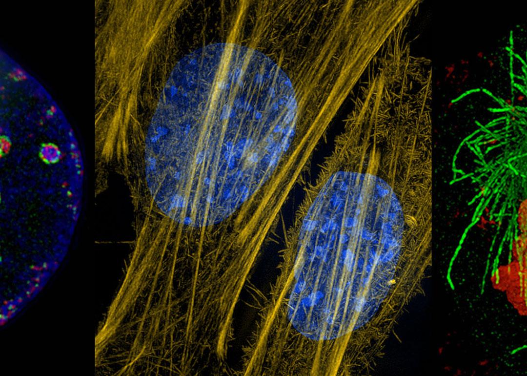 Composite of three mages from new microscope technology show a cell's replication machinery in green, already-replicated DNA is red and DNA bundled into chromatin in blue. At center, the cytoskeleton’s actin fibers in mouse connective tissue cells are seen in yellow; cellular DNA is stained blue. At right is a human cell dividing in two with its genetic material labeled in red, and the spindle apparatus that pulls the sister chromatids apart labeled in green.