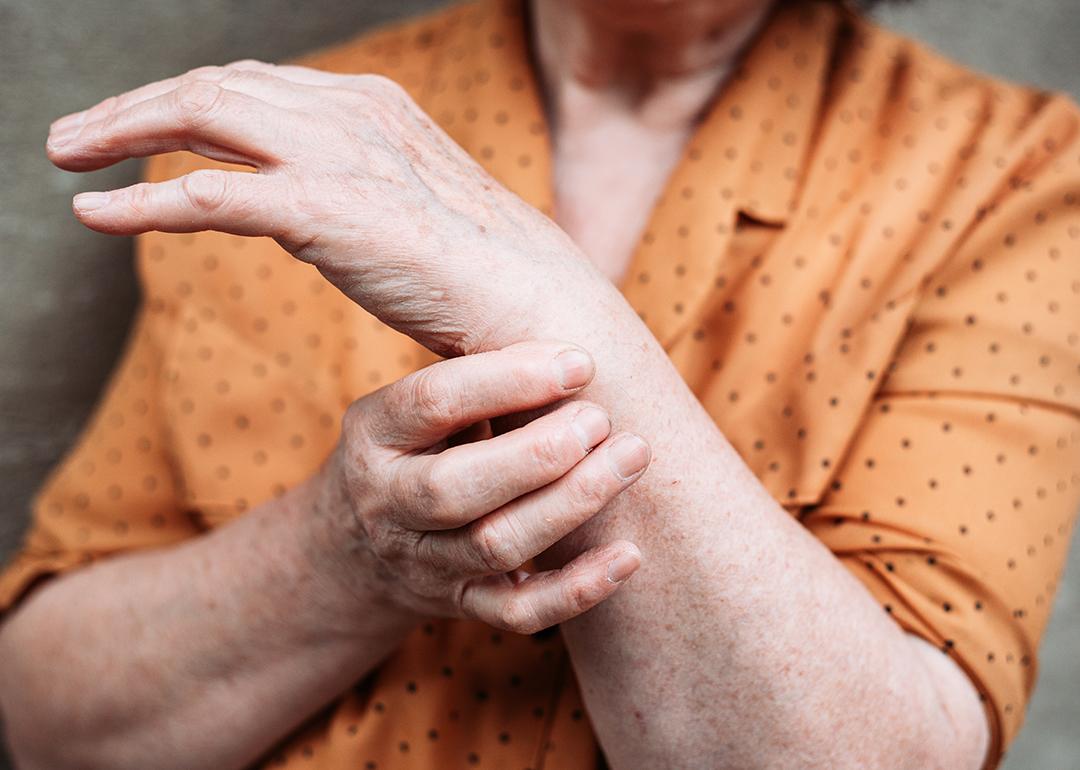 An elderly woman's hands experiencing pains.