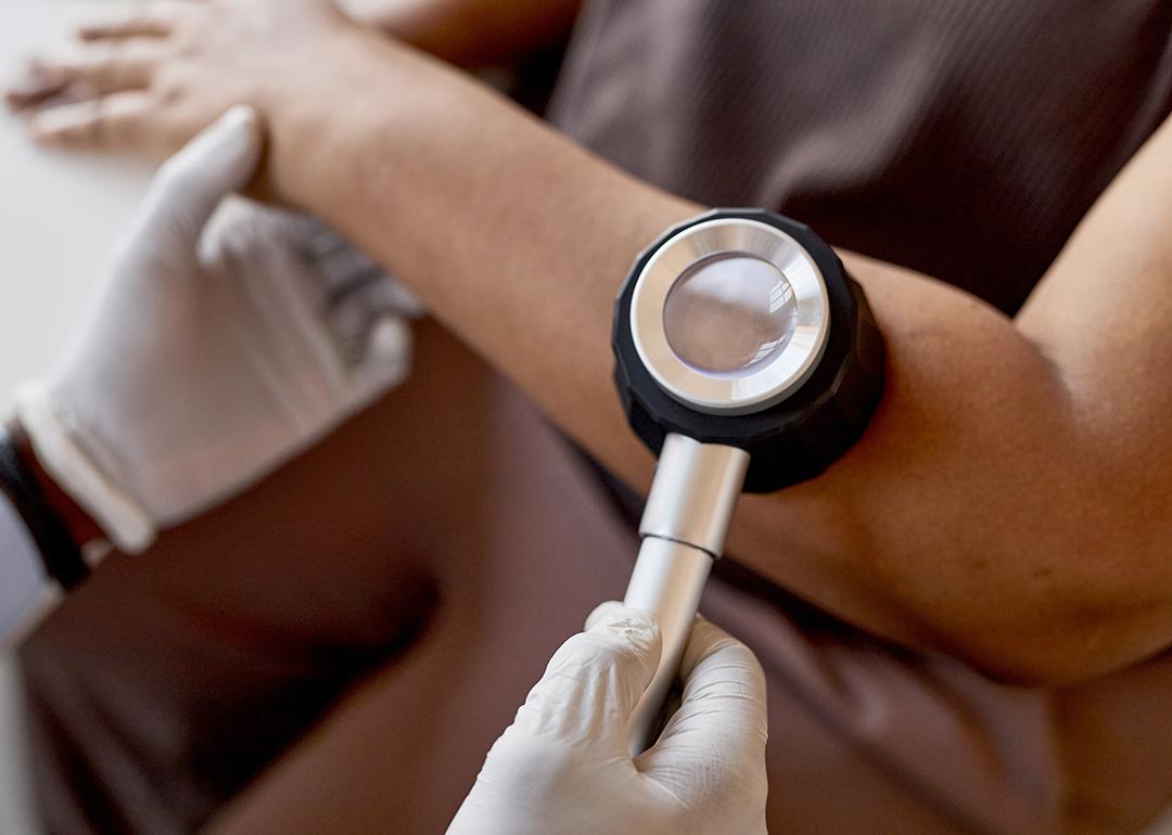 A doctor holds a dermatoscope over a patient's skin to examine for skin cancer.