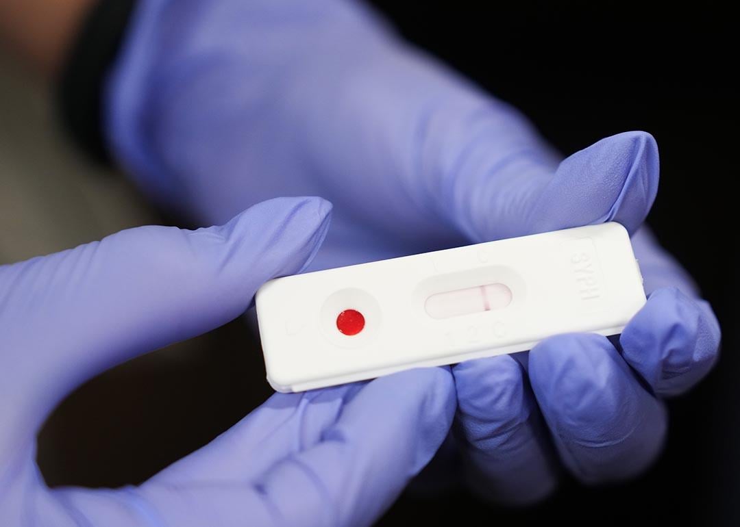 Dr. Ana Davie shows what a negative test for congenital syphilis looks like in just ten minutes at Memorial Hermann - TMC on Wednesday, June 12, 2024 in Houston.