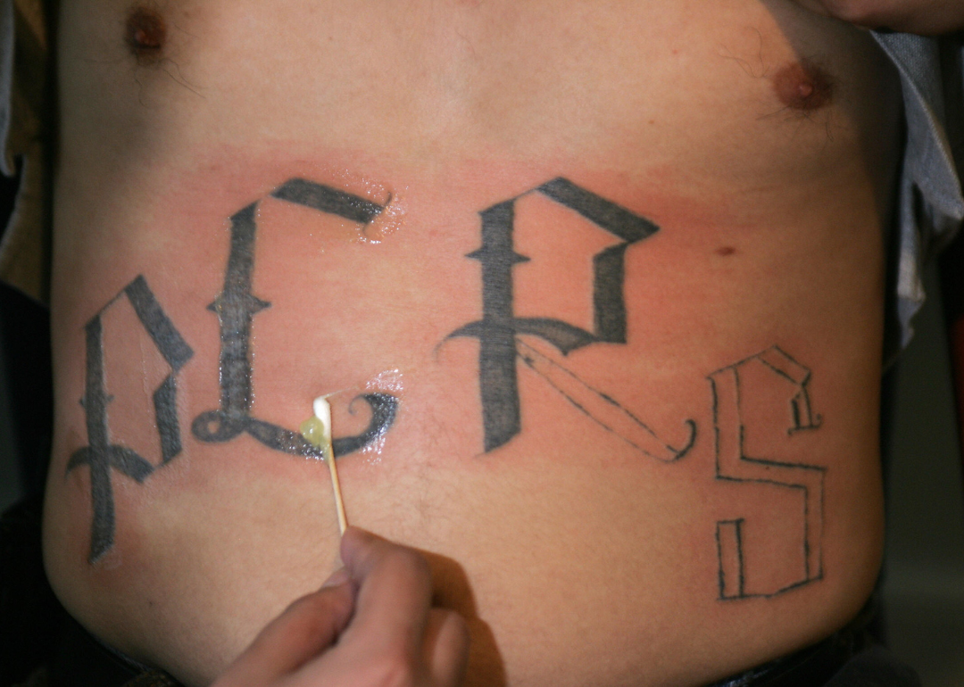 A close-up image of a person's hand using a cotton swab to apply ointment to a partially removed tattoo on the stomach of a man. The letters Y, E, R, and S are in view with part of the R and S removed. 