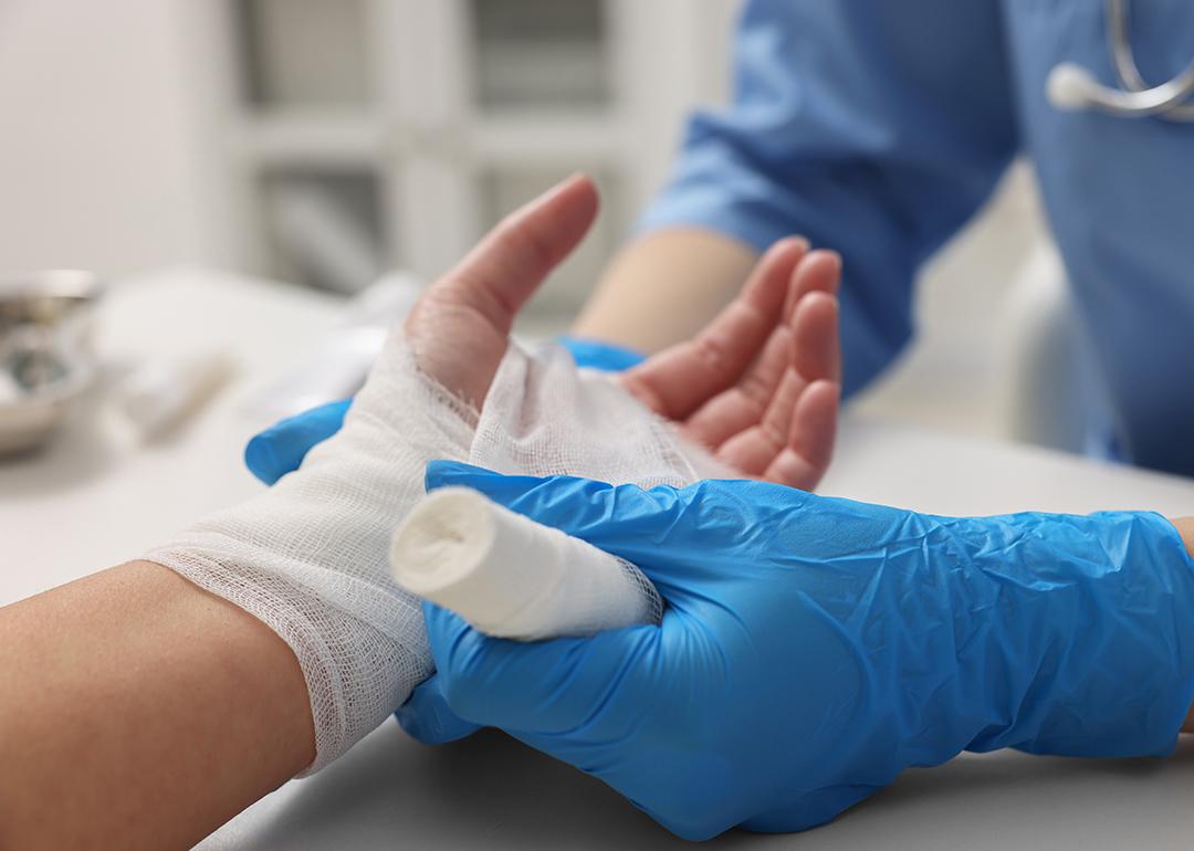 A doctor bandaging a patient's burned left hand.