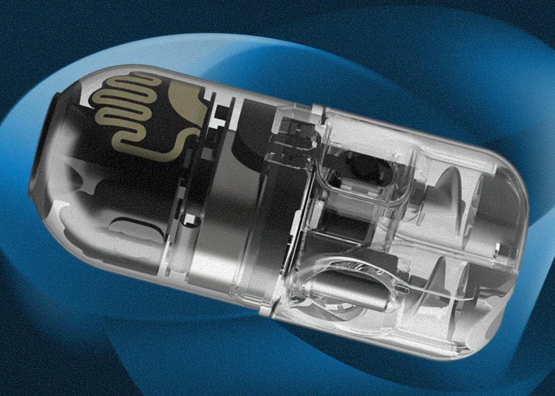 An ingestible robot that moves within the stomach using pump-jet motors would enable clinicians to control a gastric exam in real time without the cost and complexity of traditional endoscopy.