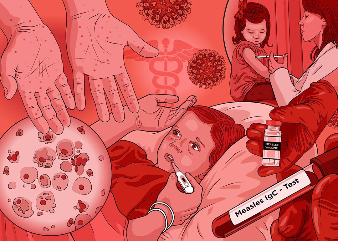 A custom illustration featuring children surrounded by graphics of the Michigan measles outbreak.