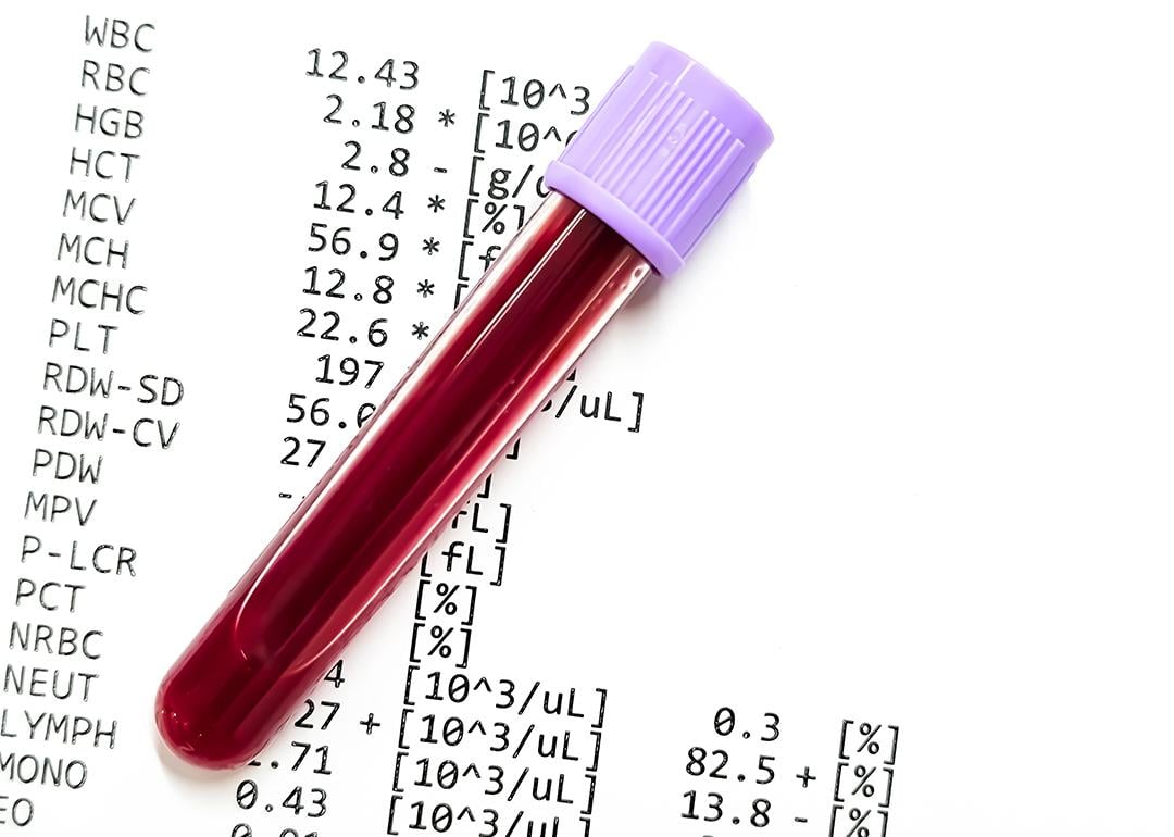 A blood sample over a CBC report document.