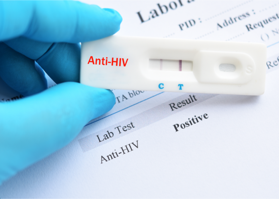 Положительный тест на СПИД. Rapid Bio тест ВИЧ. Экспресс тест на ВИЧ положительный. Положительный тест на ВИЧ фото. Вич тест беременность
