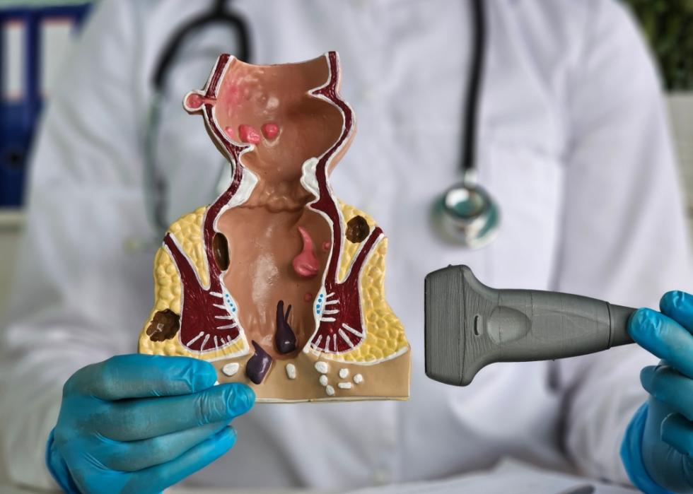 A health care professional, wearing a white coat and gloves, holding a detailed anatomical model of the human rectum and anus. The professional is also holding an ultrasound probe.