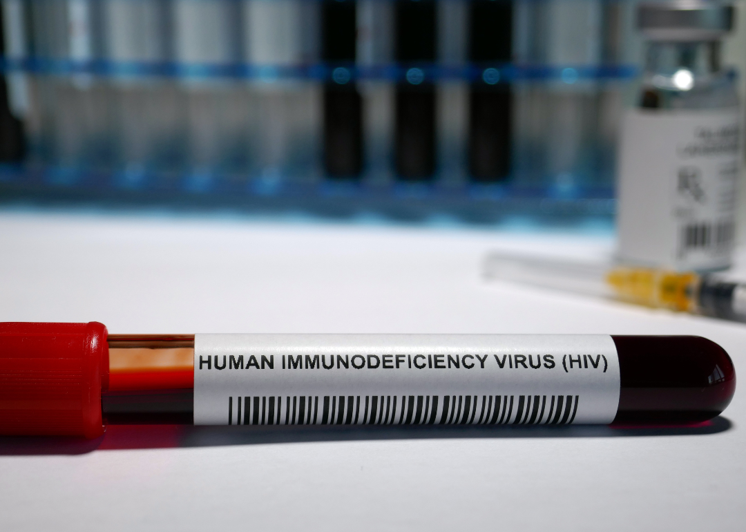 A test tube of blood labeled human immunodeficiency virus