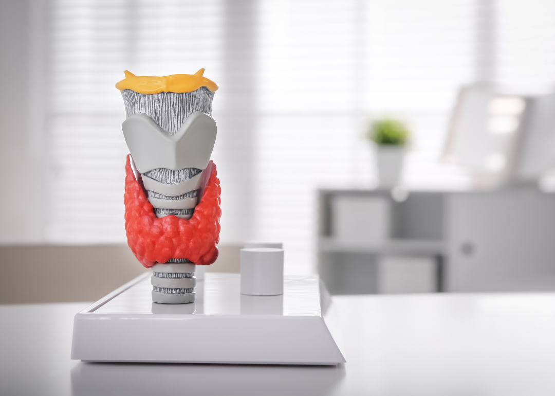 A thyroid gland model on a white table.