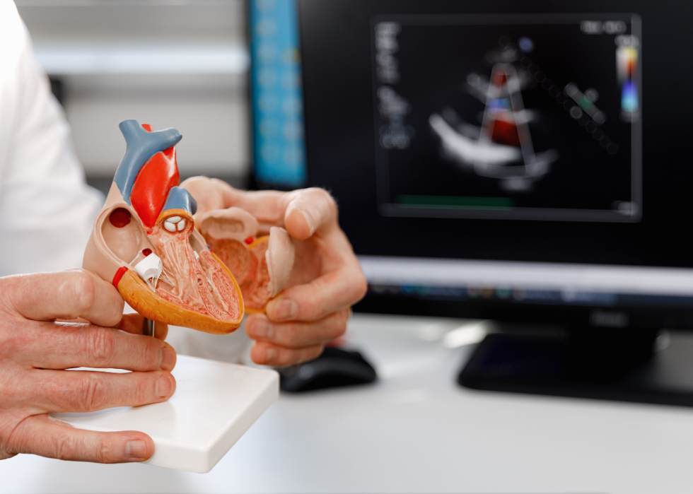 A cardiologist holds a model of the heart.