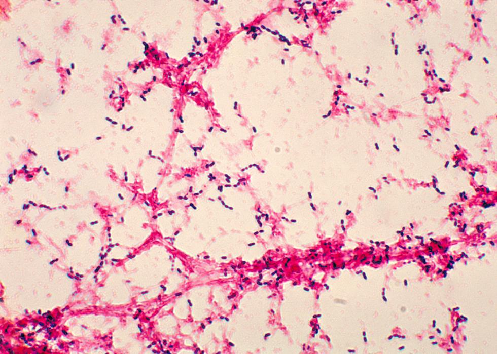 Antécédents médicaux depuis l année de votre naissance 