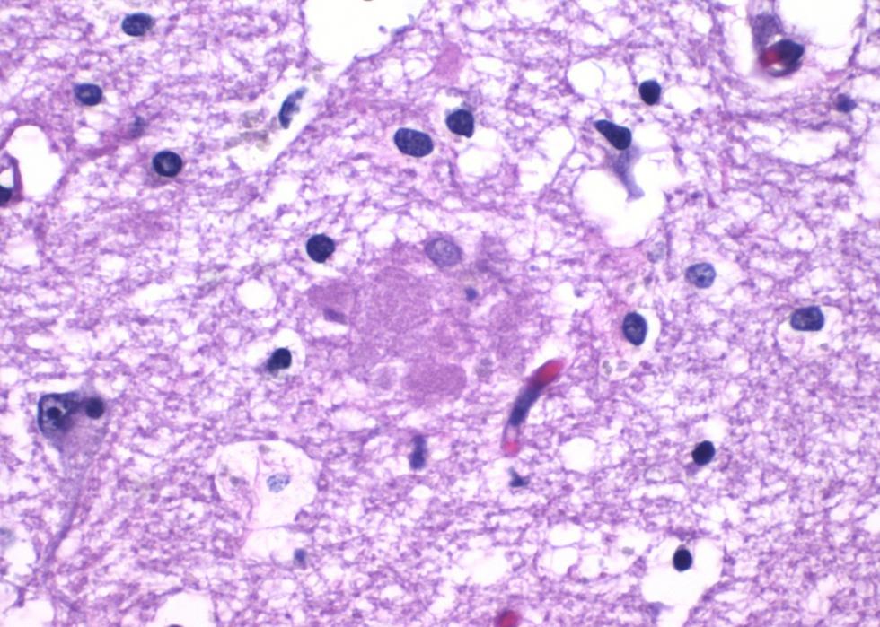 Antécédents médicaux depuis l année de votre naissance 