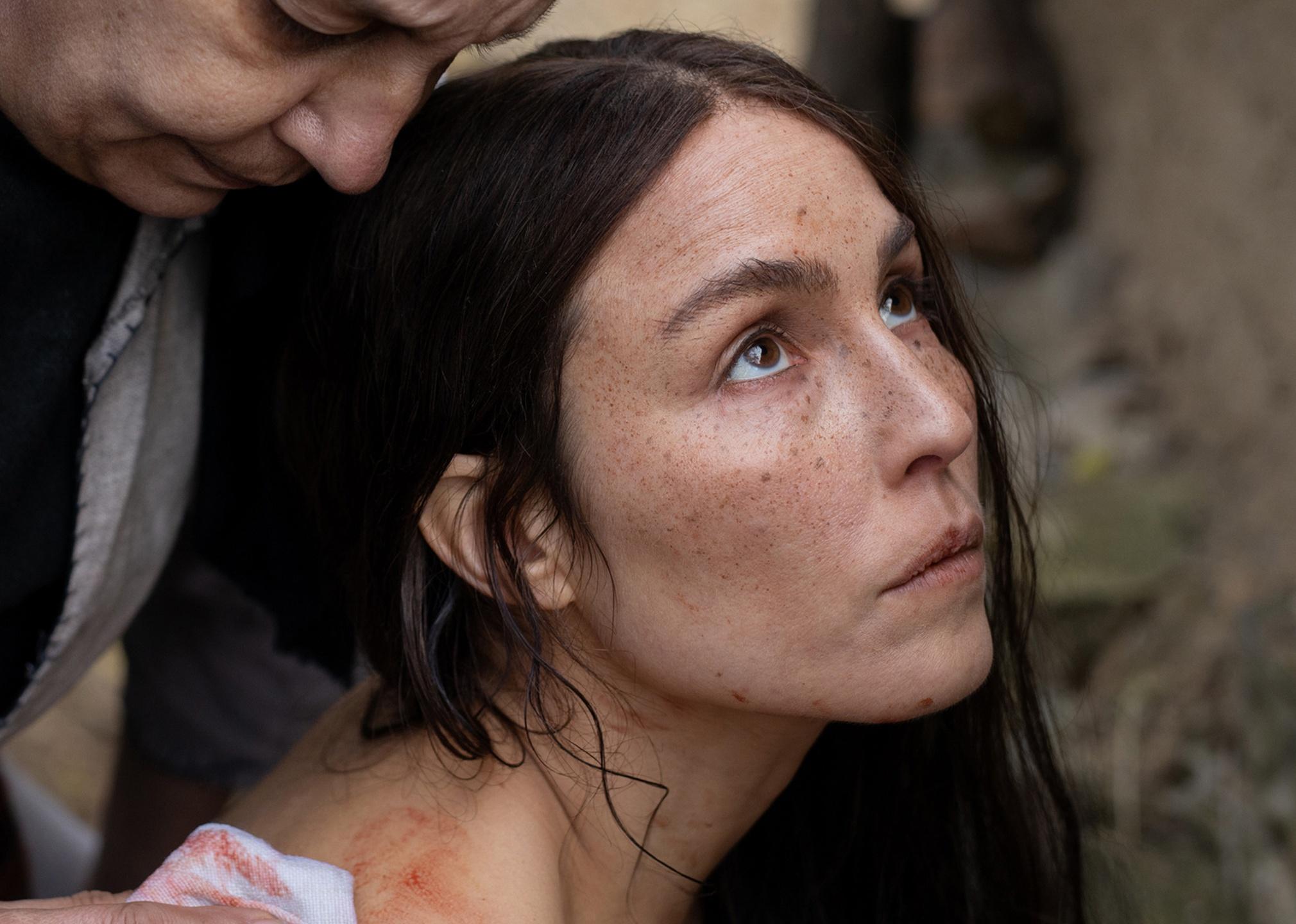A woman with dark hair and freckles looks up while an older woman wipes blood off her shoulder