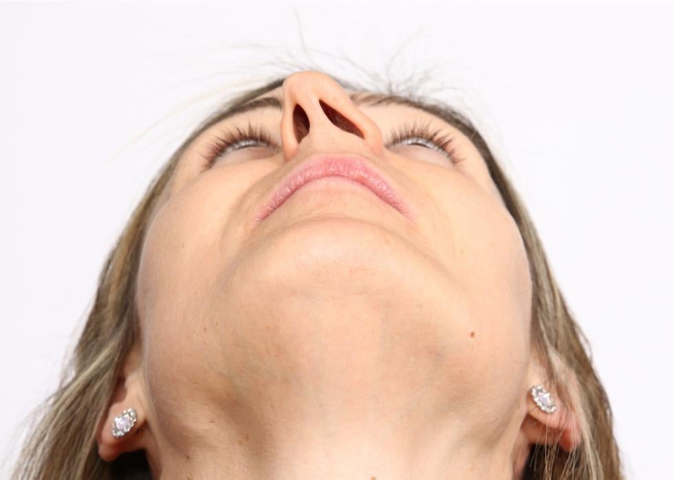 Woman leaning her face back to show her deviated septum.
