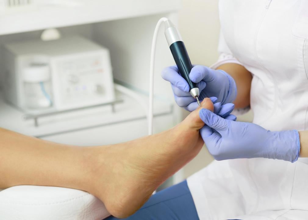 Close-up of a person's foot being treated by a podiatrist.