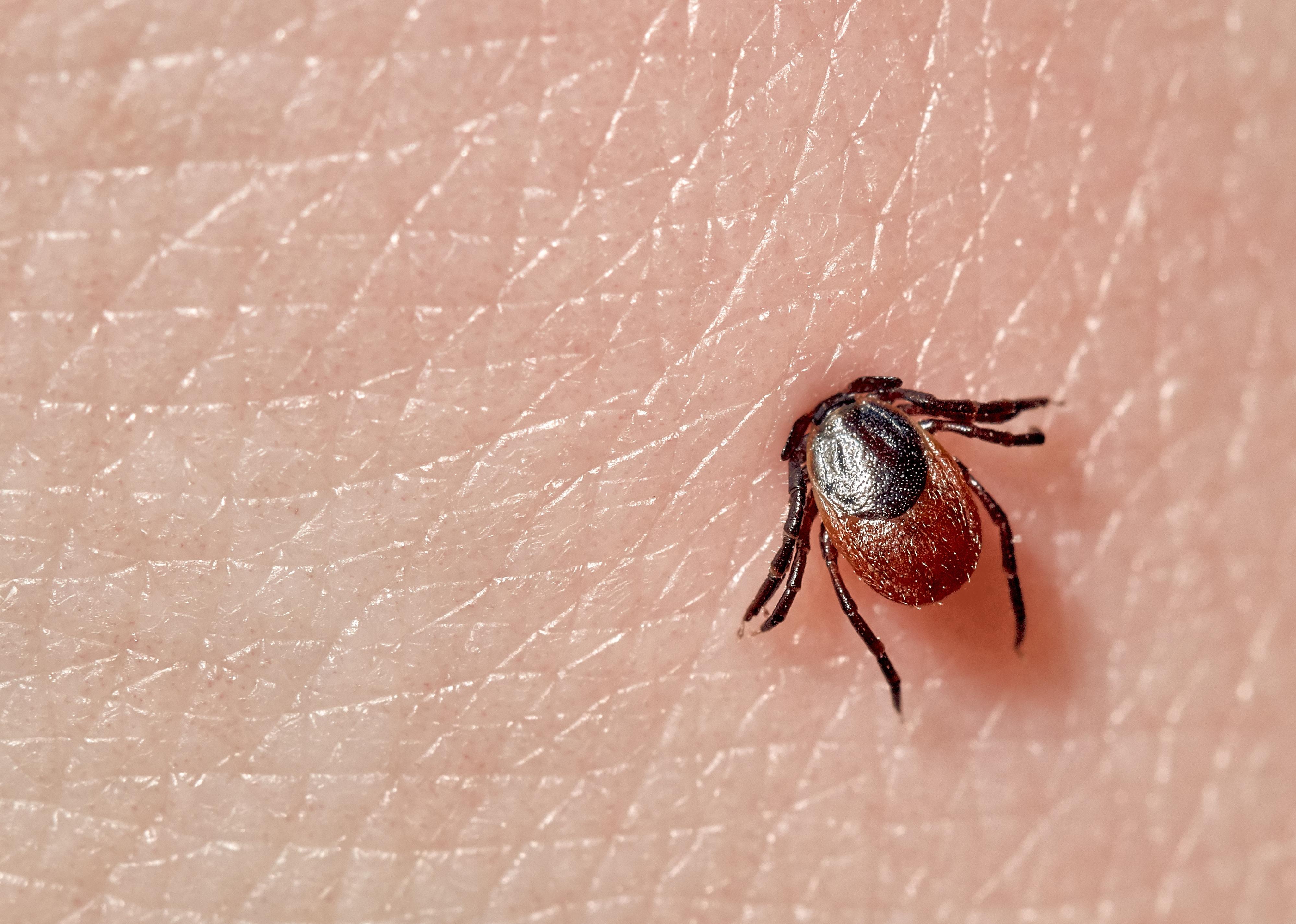 Macro photo of a  tick on human skin.