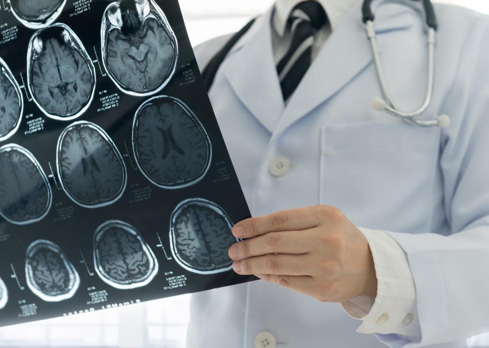 A neurologist looking at brain images.